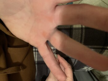 消费者安全报告 I got scammed. I purchased a “14 kt” ring that was fake Fake ring. Turned finger green. 照片 #1