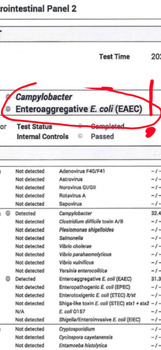 Consumer Review - Food Safety The Sakala Resort Bali, Jalan Pratama, Benoa, Badung Regency, Bali, Indonesia Food poison E Coli and... photo #7