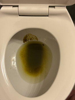 Avaliação do consumidor - Segurança alimentar Springfield, IL, USA Horrible nausea pain diarrhea foto #3