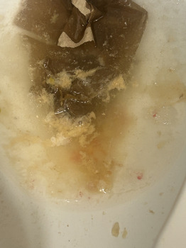 Reseña del consumidor - Seguridad alimentaria Popeyes Louisiana Kitchen, Lake Road, Seville, OH, USA Hi, I am a truck driver. Yesterday for lunch... foto #1