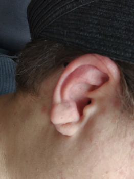 Reseña del consumidor - Seguridad alimentaria MingHin Cuisine, South Archer Avenue, Chicago, IL, USA The day after (4/24/26) I ate at Minghin (4/2... foto #1