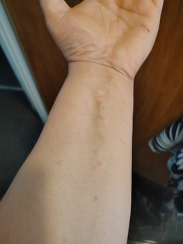 Reseña del consumidor - Seguridad alimentaria MingHin Cuisine, South Archer Avenue, Chicago, IL, USA The day after (4/24/26) I ate at Minghin (4/2... foto #2