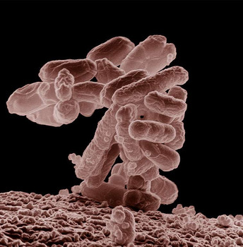 爆发 Escherichia Coli Outbreak Investigation linked to Ground Beef In May 2026, an outbreak of Escherichi... 照片 #2