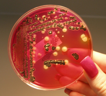 Outbreak Salmonella Outbreak linked to Egg in Belgium An outbreak of Salmonella in Belgium linked to eggs has... photo #2