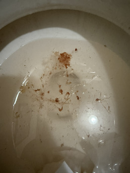 Consumer Review - Food Safety Hometown Hibachi, North Paint Street, Chillicothe, OH, USA We ordered chicken and steak hibachi with... photo #2