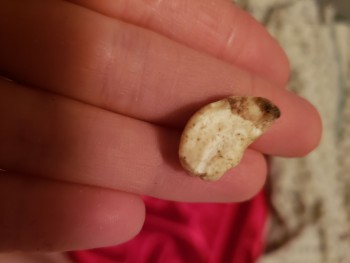 Bericht über die Lebensmittelsicherheit der Verbraucher Bulk Barn, 32 Avenue Northeast, Calgary, AB, Canada Moldy cashews Foto #1