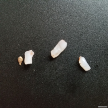 Reseña del consumidor - Seguridad alimentaria The Cheesecake Factory, Polaris Parkway, Columbus, OH, USA My husband and I ate there earlier this m... foto #6