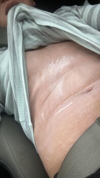 Avis du consommateur - Sécurité alimentaire Hayes Venenosos - Plantas, Warwick, Rhode Island, USA Estoy todo rojo y no puedo respirar. Tengo tre... photo #6