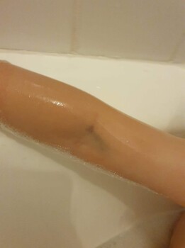 Consumer Review - Food Safety KFC Parklea, Almona Street, Glenwood NSW, Australia Chicken nuggets My 2 year old nephew nearly died... photo #5