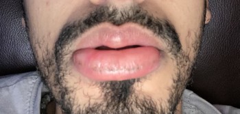 Consumer Review - Food Safety Sam's Club, Lycoming Mall Circle, Muncy, PA, USA I ate a banana and my lips swole, mouth was itching... photo #2