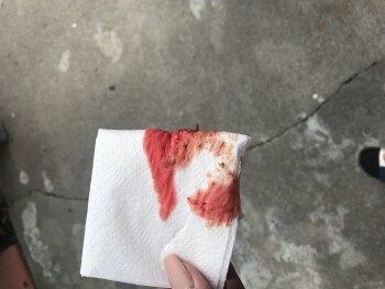 Dream bones have made both of my dogs sick 照片 #1