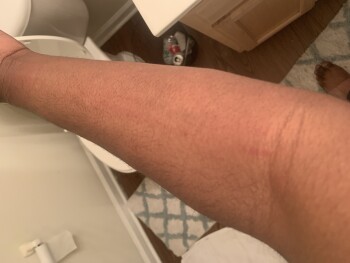 Consumer Review - Food Safety Smoothie King, 5955 Poplar Avenue, Memphis, TN, USA I had not ate at all today. I broke out with a a... photo #1