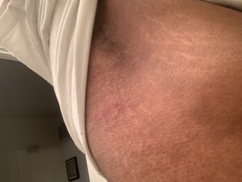 Consumer Review - Food Safety Smoothie King, 5955 Poplar Avenue, Memphis, TN, USA I had not ate at all today. I broke out with a a... photo #2