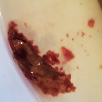 مراجعة المستهلك - سلامة الغذاء Food Pantry, Morris Park Avenue, The Bronx, Bronx, NY, USA Severe stomach pains, diarrhea and blood... صورة فوتوغرافية #2