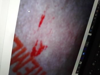 Relatório de segurança alimentar do consumidor Taco Bell, Tacoma, WA 98445, USA Blood on my wrapper foto #6