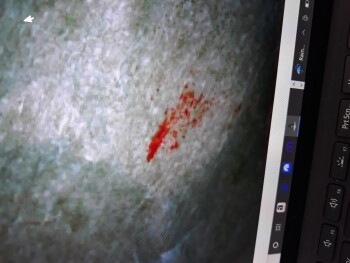 Relatório de segurança alimentar do consumidor Taco Bell, Tacoma, WA 98445, USA Blood on my wrapper foto #4