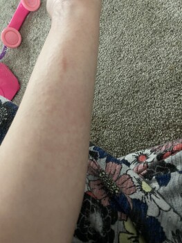 Consumer Review - Food Safety Taco Bell, Northwest Barry Road, Kansas City, MO, USA Allergic reaction to coffee, I called corporat... photo #1