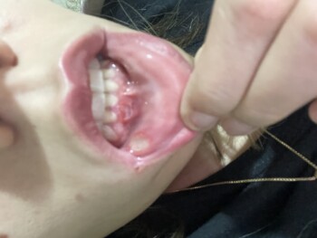 KFC - Kentucky Fried Chicken - Rod. Celso Garcia Cid, 5600 - Gleba Fazenda Palhano, Londrina - PR, 86050-901, Brazil foto #1