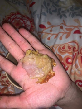 Avis du consommateur - Sécurité alimentaire Air Buns Berlin, Silbersteinstraße, Berlin, Germany Suspected food poisoning. Symptoms: Diarrhea, Na... photo #1